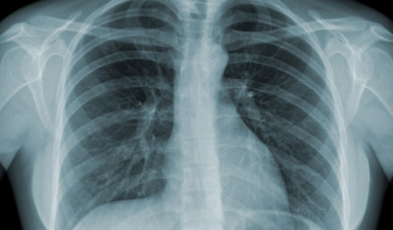 Medical Imaging Analysis